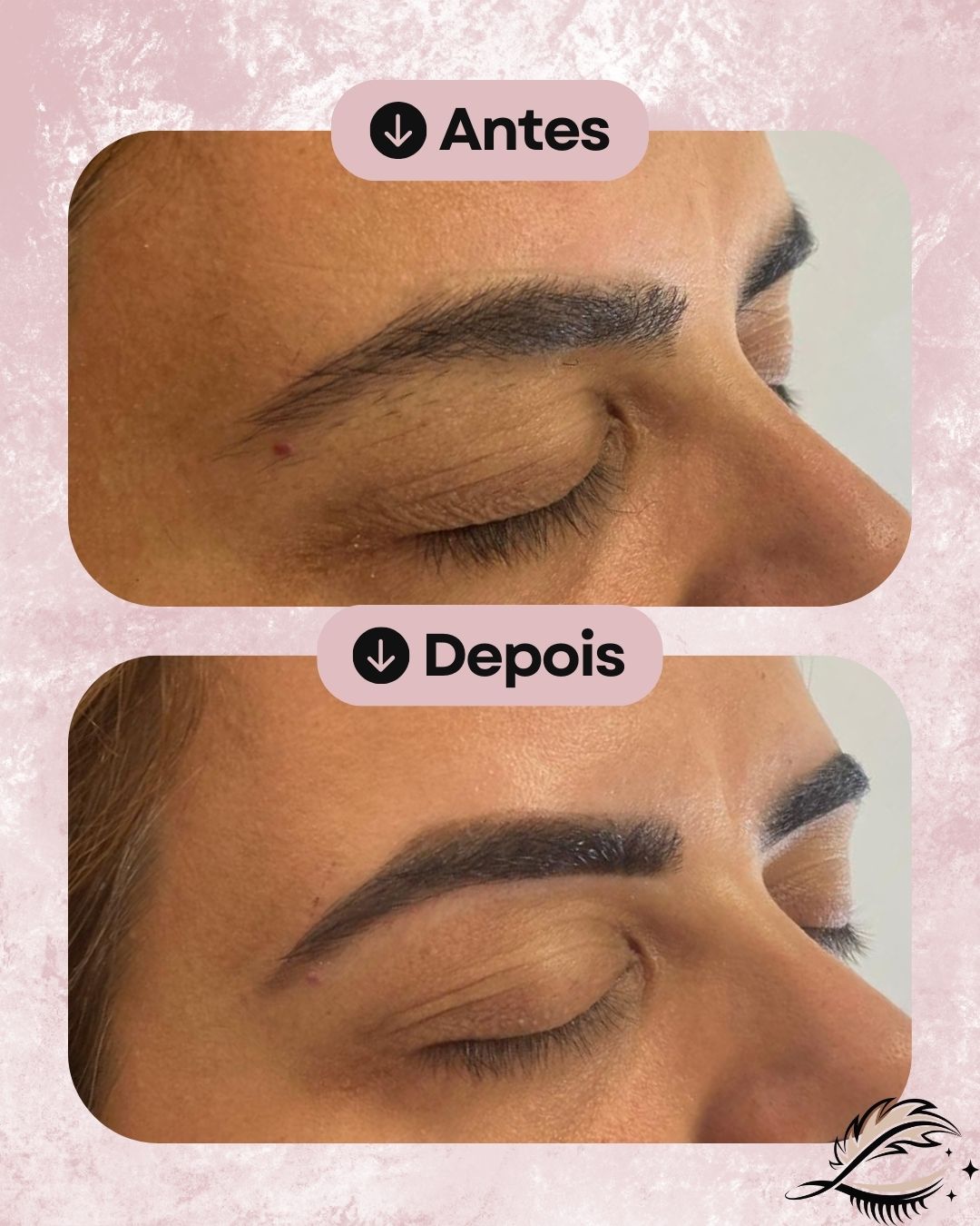 Resultado de design de sobrancelhas à linha, caso 3