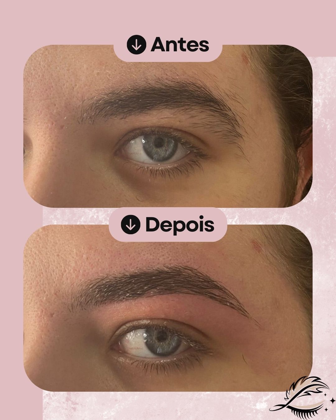 Resultado de design de sobrancelhas à linha, caso 6